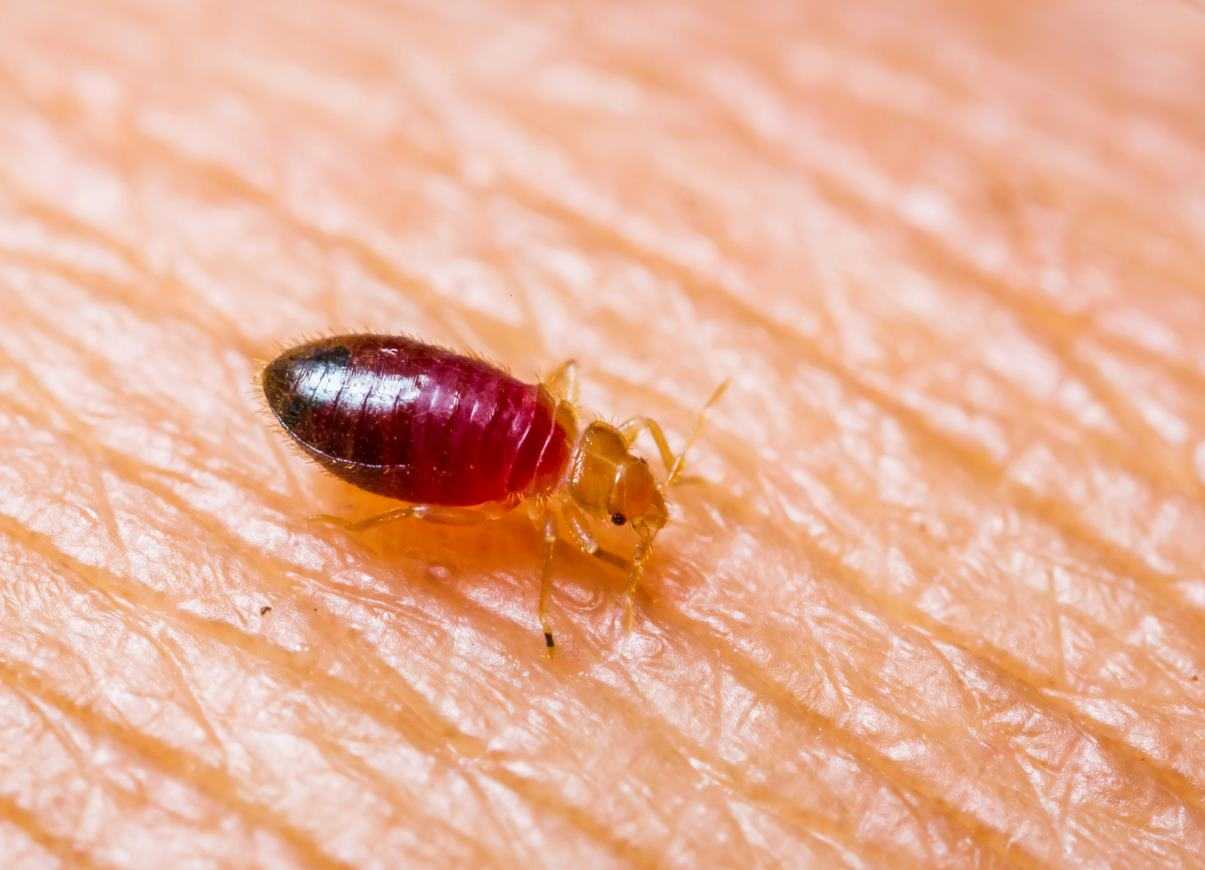 A closeup of a tiny bed bug sitting on someone’s skin