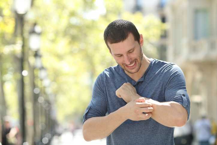 adult man scratching a bug bite on his arm in the street