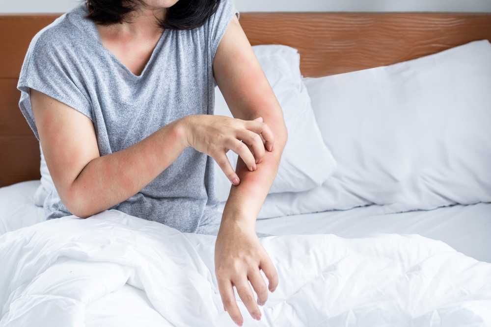A person sitting on a bed scratches a red, irritated rash on their left forearm—possible symptoms of dust mites. They wear a gray T-shirt and white bedding is visible as they try to protect themselves. Their face is partially out of frame.